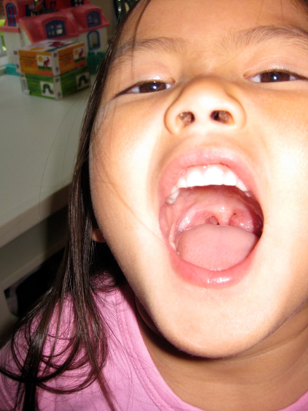 Bronze O. recomended mouth uvula girl
