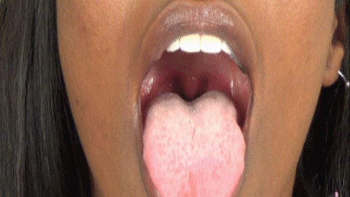 best of Spit check tongue lots and uvula with