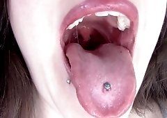 Cinnamon recommendet spit uvula lots tongue and check with