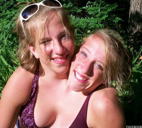 best of Of sex having pictures conjoined twins porn