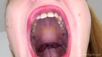 Tongue and uvula check with lots spit