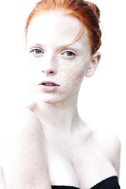 Freckled Hairy Freckle Hairy Freckles Redhead Hairy Freckled Redhead Girls With Freckles Random Jpg