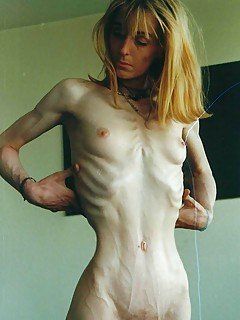 Bentley reccomend Really skinny women nude