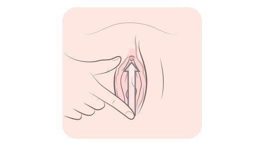 Whisky G. reccomend What to do if your labia ripped from masturbation