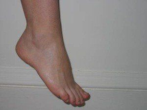 Doppler reccomend Chipped polish foot fetish